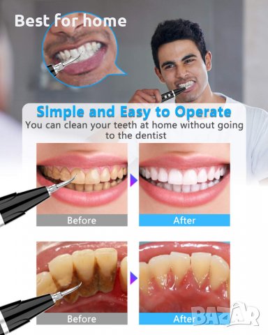 Ултразвуков уред за почистване на зъби - плака и зъбен камък, снимка 3 - Друго оборудване - 38892436