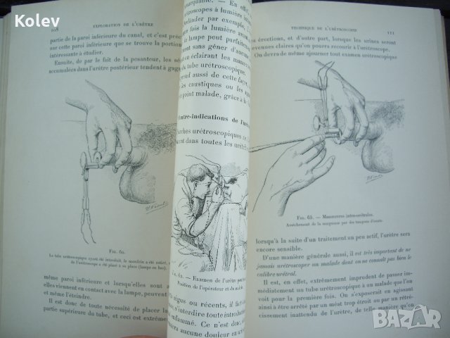Медицинска книга Изследване на уринарната система, 1909 , френска, снимка 10 - Специализирана литература - 33406019