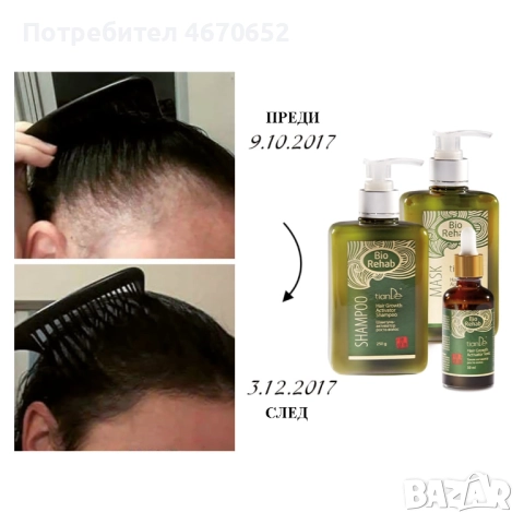 Коледен комплект за коса Bio Rehab, снимка 2 - Продукти за коса - 52689072