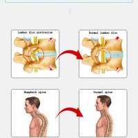 Масажор за изправяне на гърба - болки в горната и долната част на гърба , снимка 2 - Масажори - 27135214