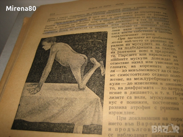 Учебник по детски инфекциозни болести - 1948 г., снимка 8 - Специализирана литература - 53528977