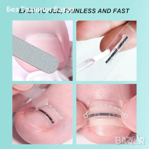 Нов Комплект за корекция на врастнали нокти 9 броя 3 размера лечение, снимка 3 - Други - 51581019