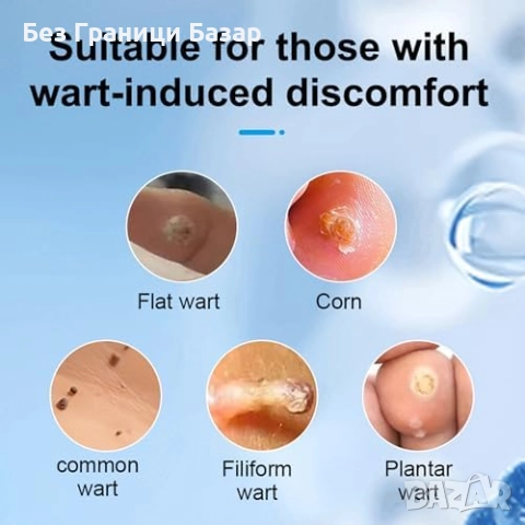Нов Комплект за премахване на брадавици, петна и мазоли 4 мл гел писалка, снимка 4 - Други - 51608861