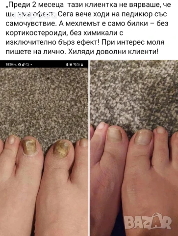 Пчелен мехлем за гъбички по ноктите и кожата, снимка 2 - Други - 47812010