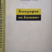 Томография на костите. Г. Хаджидеков, Б. Ботев 1957 г., снимка 1 - Специализирана литература - 27589751