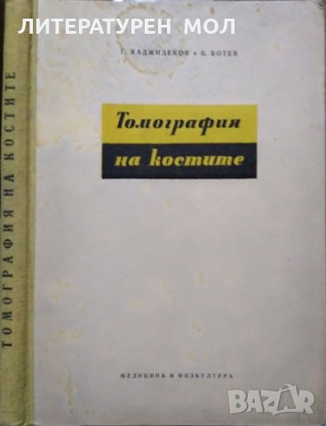 Томография на костите. Г. Хаджидеков, Б. Ботев 1957 г.