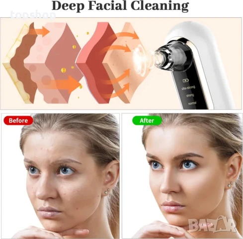 Уред за почистване на черни точки и грижа за лице Y002 + инструменти, снимка 6 - Маши за коса - 50493140