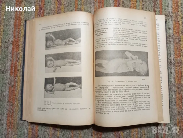 Основи на микро педиатрията ( болести на първото детство ), снимка 13 - Специализирана литература - 47932904