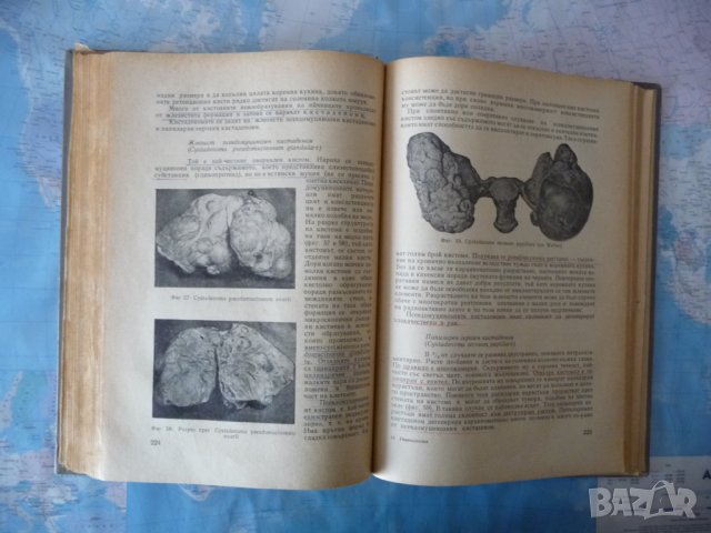 Гинекология Илия Щъркалев гинекологичен преглед женски полови органи, снимка 3 - Специализирана литература - 40729925