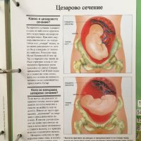 Енциклопедия на ЗДРАВЕТО, снимка 5 - Енциклопедии, справочници - 43799418