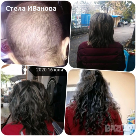 Комплект за бърз растеж на косата, при косопад, оплешивяване, алопеция, снимка 6 - Продукти за коса - 53222898