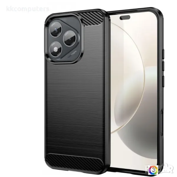 Honor 400 Lite Удароустойчив Carbon Fiber Калъф и Протектор, снимка 1