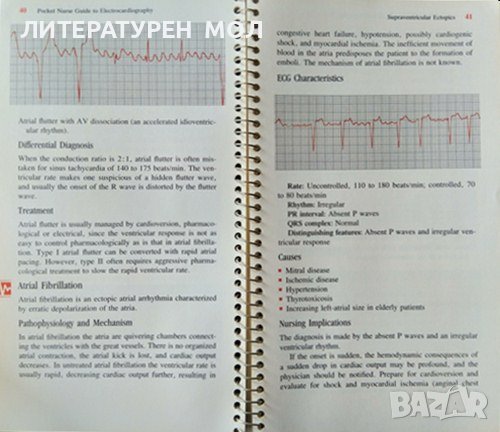 Pocket Guide to Electrocardiography. Revised Edition. Mary Boudreau Conover 1986 г. 367 illustration, снимка 4 - Специализирана литература - 37691834