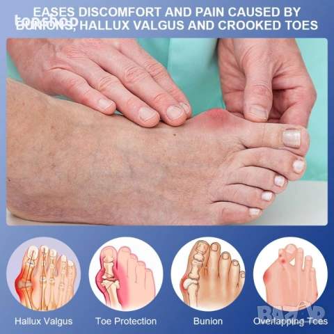 Пълен комплект за двата крака коректори за кокалче (Hallux Valgus) ACWOO – 4 части, снимка 2 - Ортези и протези - 53277251