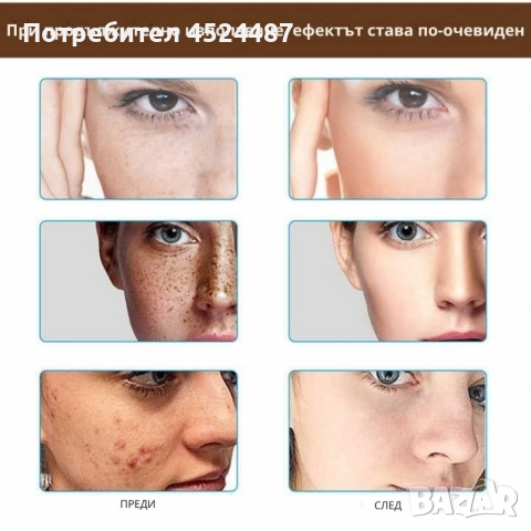 Крем за лице Mixia Rice Pretty Facial Cream - Избави се от акне, петна и пигментации, снимка 5 - Други - 52658444