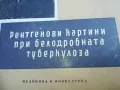 ТУБЕРКОЛОЗА 2210241119, снимка 4