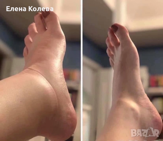 Фитогел „Славитон“, снимка 8 - Други - 52102028