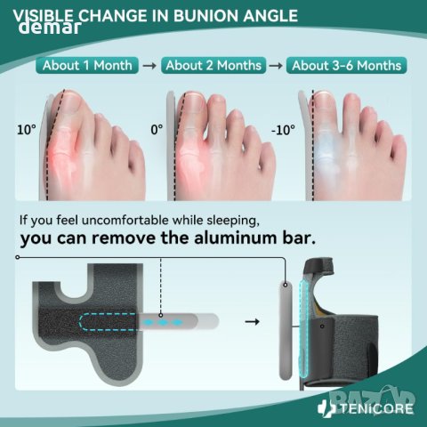 TENICORE Регулируеми шини за изправяне на пръстите на краката - 1 чифт, снимка 4 - Други - 43763429