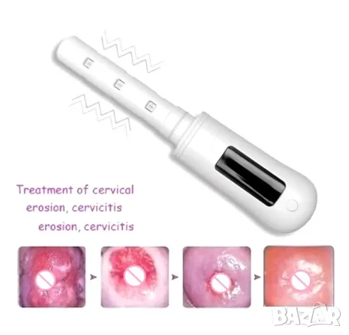 Вагинален Лазер за Вагинално Стягане на Вагиналния Мускул Лазернo Вагинално Подмладяване Стесняване, снимка 13 - Други - 50187960