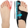 Пълен комплект за двата крака коректори за кокалче (Hallux Valgus) ACWOO – 4 части, снимка 1