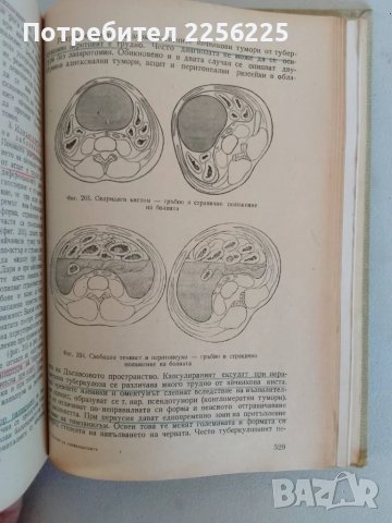 Основи на гинекологията , снимка 3 - Специализирана литература - 47482425