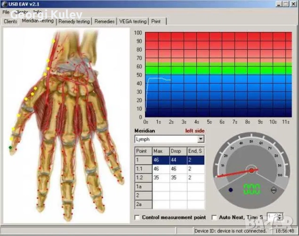 Biopulse*Вега тест*меридиан тест*терапия по EAV, снимка 2 - Уреди за диагностика - 51686016