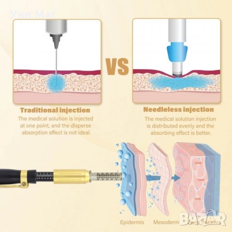 Хиалурон пен, Безиглен инжектор за мезотерапия и филъри Hyaluronic pen, снимка 5 - Козметични уреди - 30358850