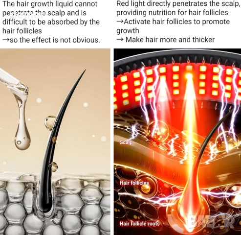 Устройство за грижа за косата-светлинна терапия, 650nm, 850nm и 450nm, снимка 3 - Други - 51457016