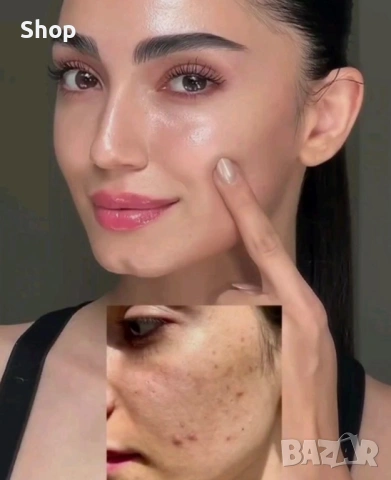 -50% Tretinoin cream 