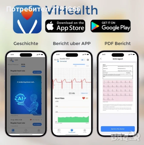 Checkme ER2 Bluetooth ЕКГ монитор до 15 минути ЕКГ запис приложение за смартфон и компютърен софтуер, снимка 3 - Други - 50746446