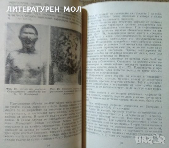 Венерическите заболявания и борбата с тях. Иван Толев 1972 г., снимка 3 - Специализирана литература - 26489345