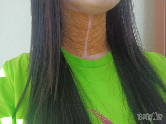 Пластири (Пейнлес) PAINLESS  налични! One More за определени заболявания, снимка 17 - Други - 36364317