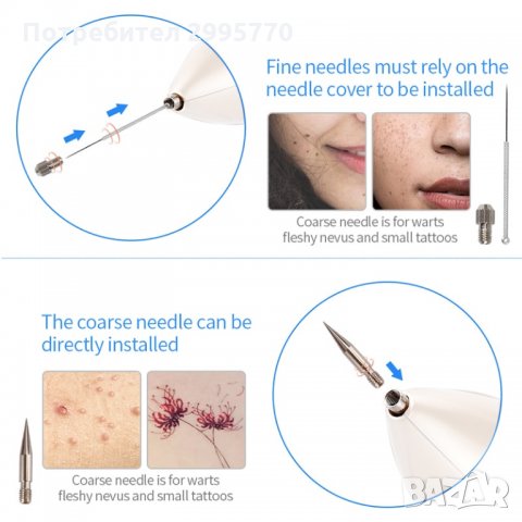 Лазерна плазмена писалка за премахване на лунички, брадавици петна татуировки бенки, снимка 5 - Други - 32481563