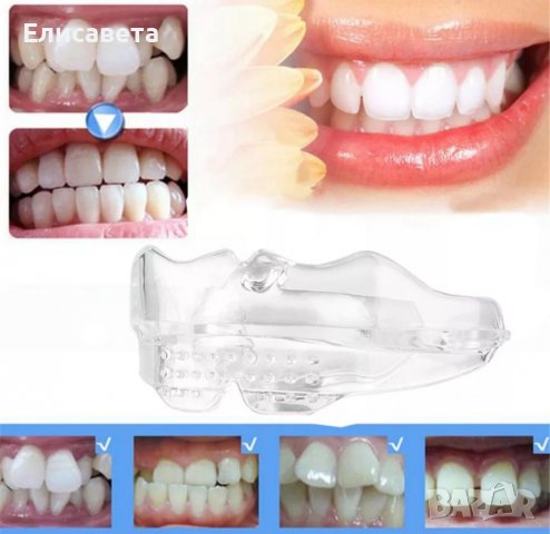 Стоматологичен ортодонтски коректор на зъби брекети зъбен фиксатор за изправяне на зъби , снимка 6 - Козметика за лице - 35167300
