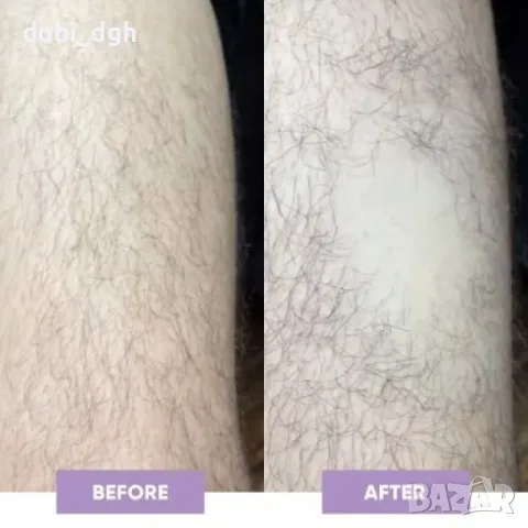 Компактен кристален уред за премахване на излишното окосмяване, снимка 5 - Козметика за тяло - 47360956