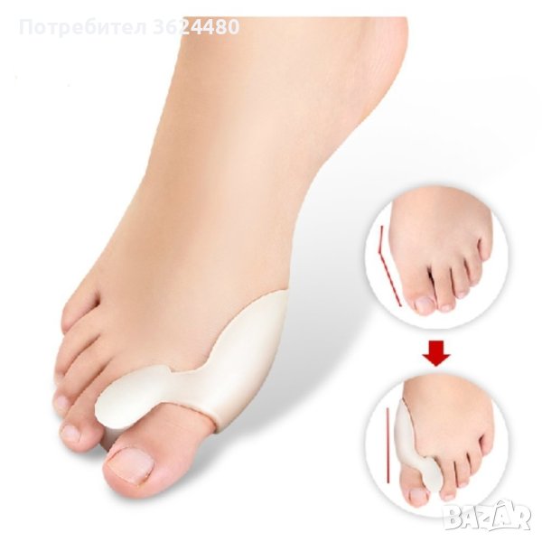 Силиконов разделител при изпъкнало кокалче , снимка 1