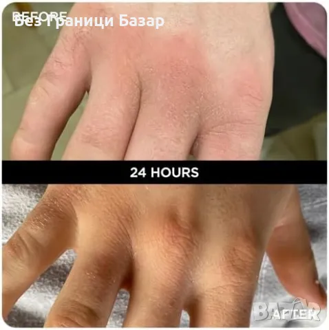 Нов Лек и бързо попиващ балсам за всекидневна грижа – 100% натурален, снимка 4 - Други - 48165122