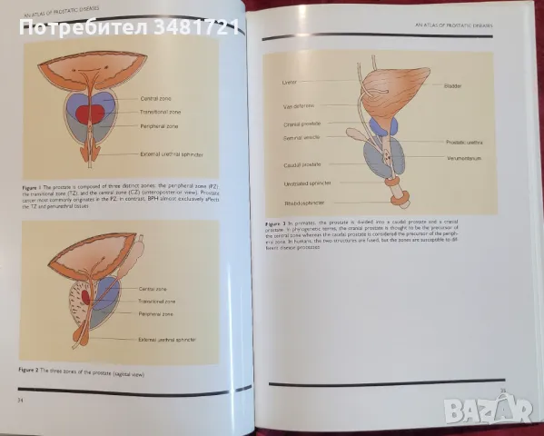 Атлас на заболяванията на простатата / An Atlas of Prostatic Diseases, снимка 4 - Специализирана литература - 48775096