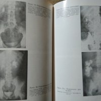 Инфекции на бъбреците и пикочните пътища 1980 г., снимка 3 - Специализирана литература - 27597900