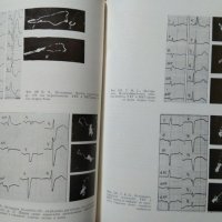 Болести на сърдечно-съдовата система  1968 г., снимка 4 - Специализирана литература - 27569788