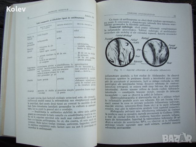 Румънска гинекология Inflamatiile aparatului genital feminin от 1958, снимка 5 - Специализирана литература - 38395783