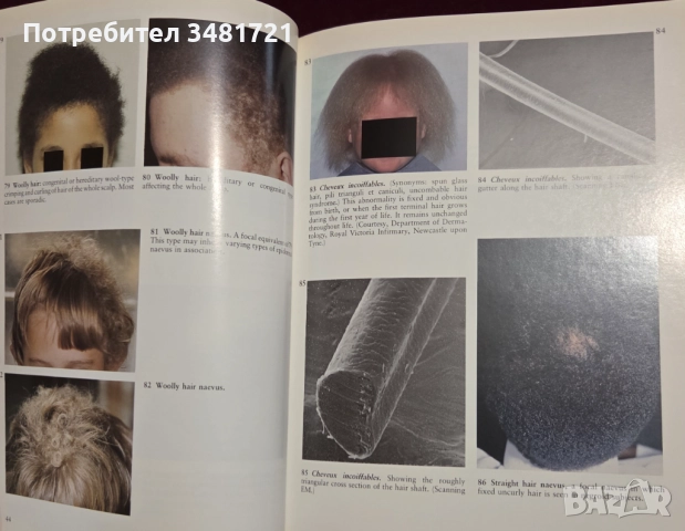 A Colour Atlas of the Hair, Scalp and Nails, снимка 7 - Специализирана литература - 52539726