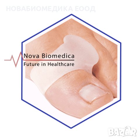 Пръстен – разделтел за пръсти, снимка 2 - Ортопедични стелки - 43299850