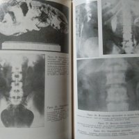 Инфекции на бъбреците и пикочните пътища 1980 г., снимка 4 - Специализирана литература - 27597900