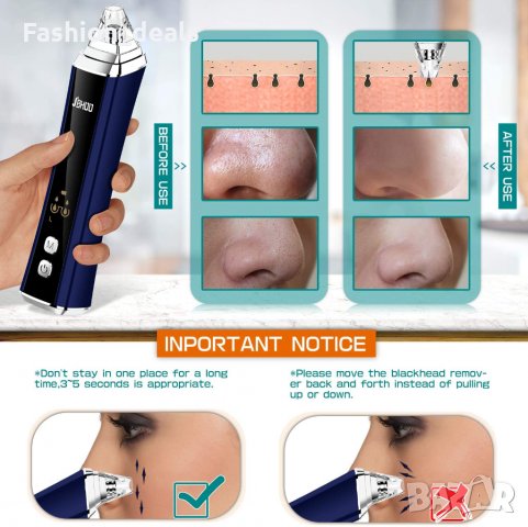 Вакуум за премахване на черни точки Инструмент за почистване на порите, снимка 6 - Други - 33620505