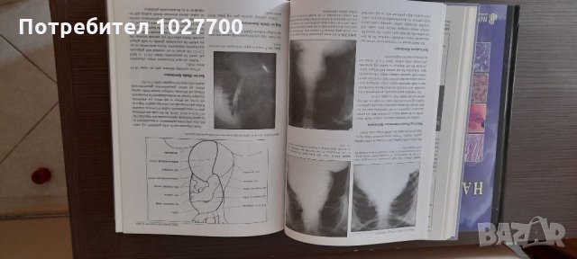 Лекарска книга на турски език за професионалисти, снимка 4 - Специализирана литература - 33068143