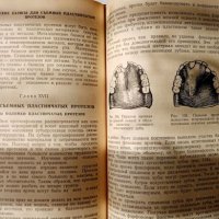 📚 Учебник 'Зубопротезная техника' от 1951 година , снимка 3 - Антикварни и старинни предмети - 26757452