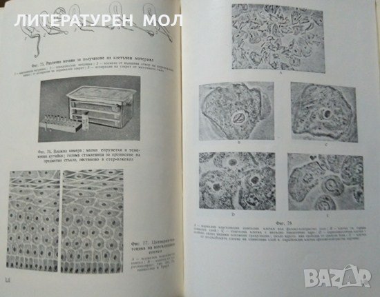 Ранна диагностика и профилактика на рака на женските полови органи. 1955 г., снимка 3 - Специализирана литература - 27589697