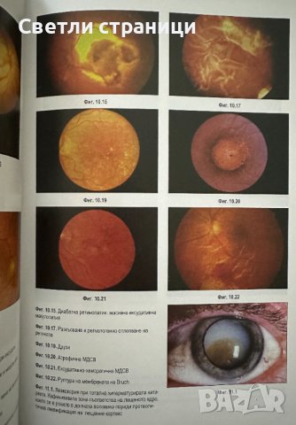 Офталмология: Патология на зрителния анализатор, снимка 8 - Специализирана литература - 44068073