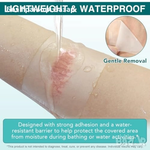 Нова Хидроколоидна ролка за рани водоустойчива ултра абсорбираща персонализируем размер и форма, снимка 5 - Други - 52470188